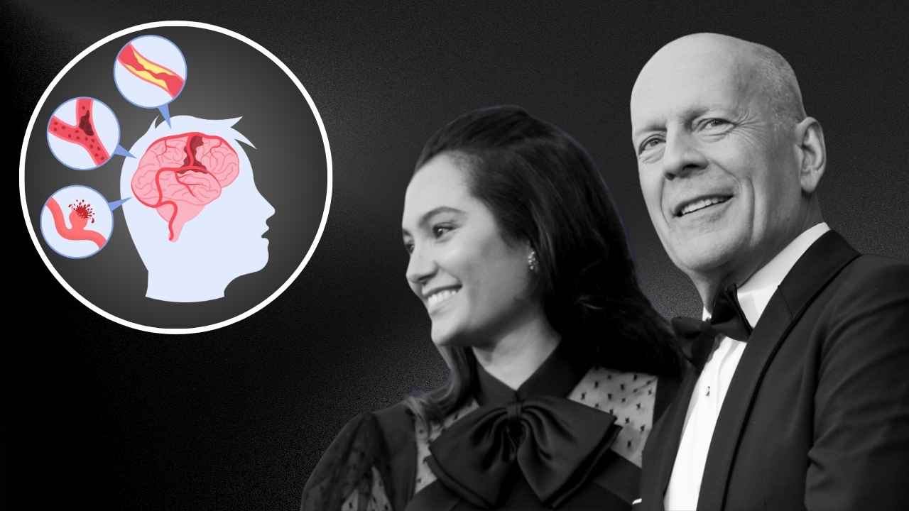 What is Frontotemporal Dementia Understanding Bruce Willis’ Diagnosis