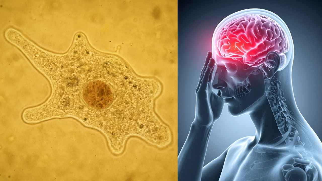 18 died by Brain-Eating Amoeba in Kerala